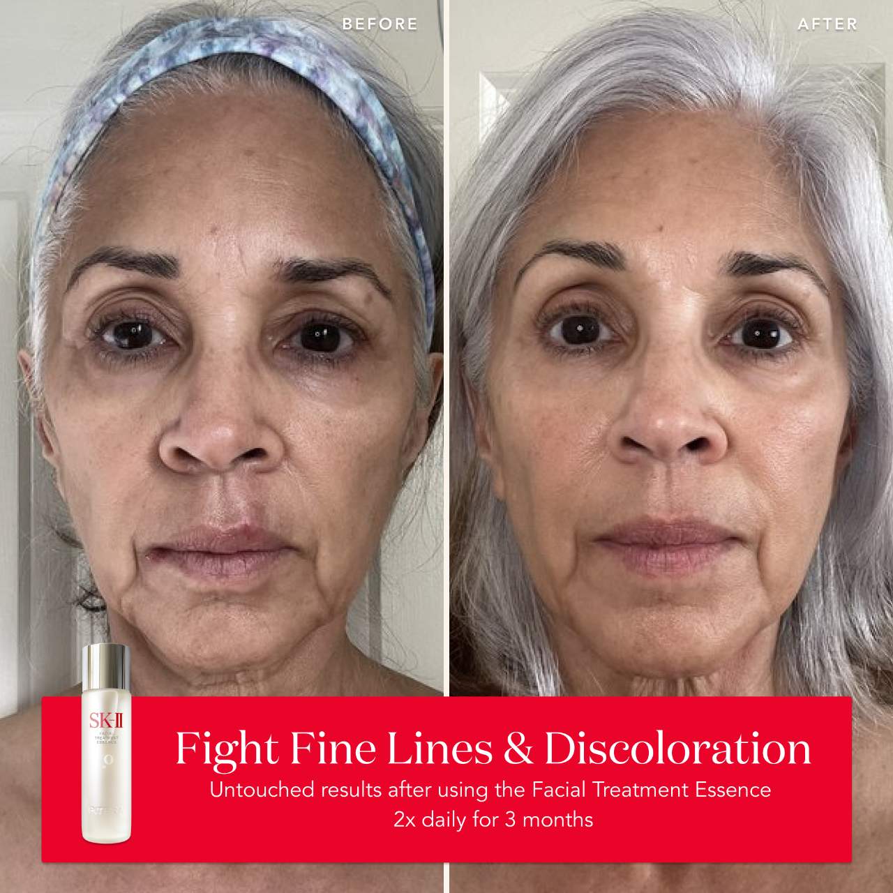 Esencia Facial Antiedad con Antioxidantes