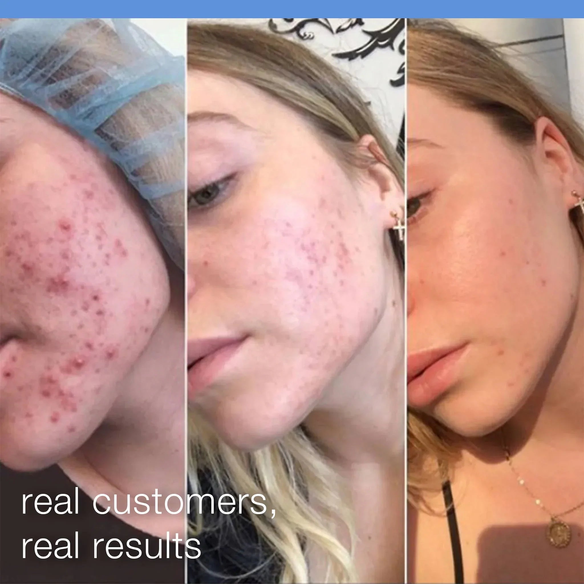 Exfoliante Daily Microfoliant Refillable – Polvo exfoliante diario recargable