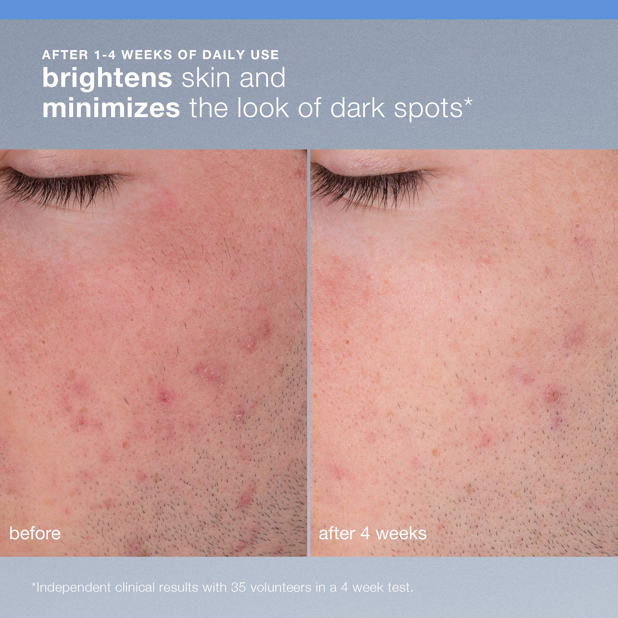 Exfoliante Daily Microfoliant Refillable – Polvo exfoliante diario recargable