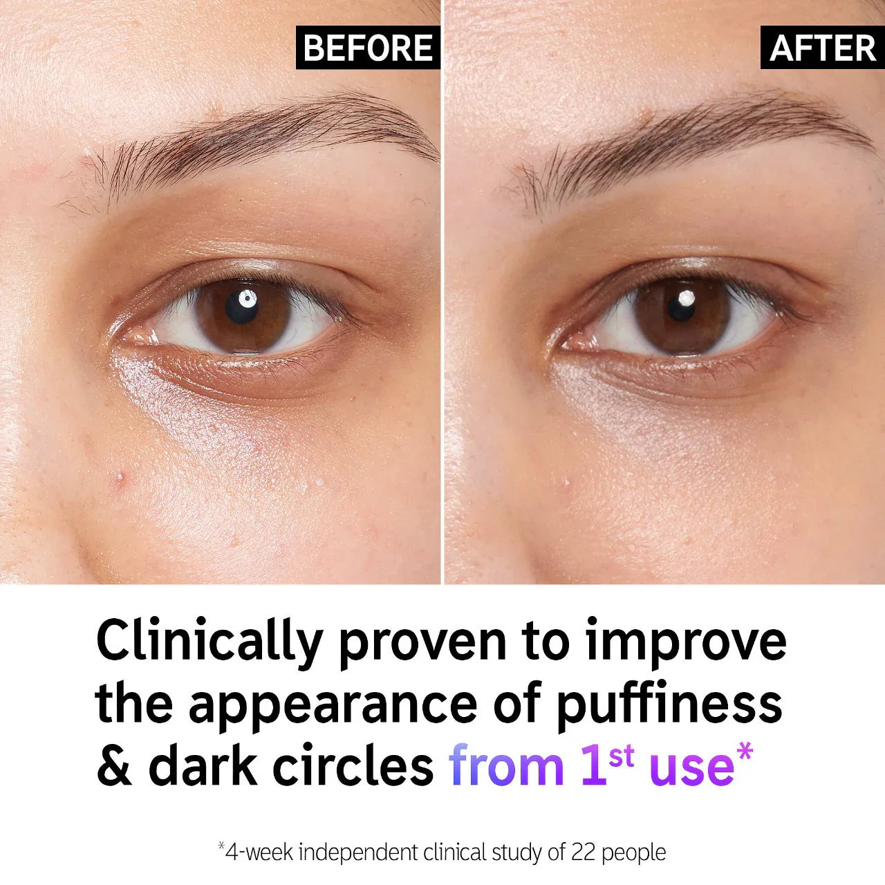 Crema de Ojos Desinflamante con Cafeína + Reductora de Ojeras