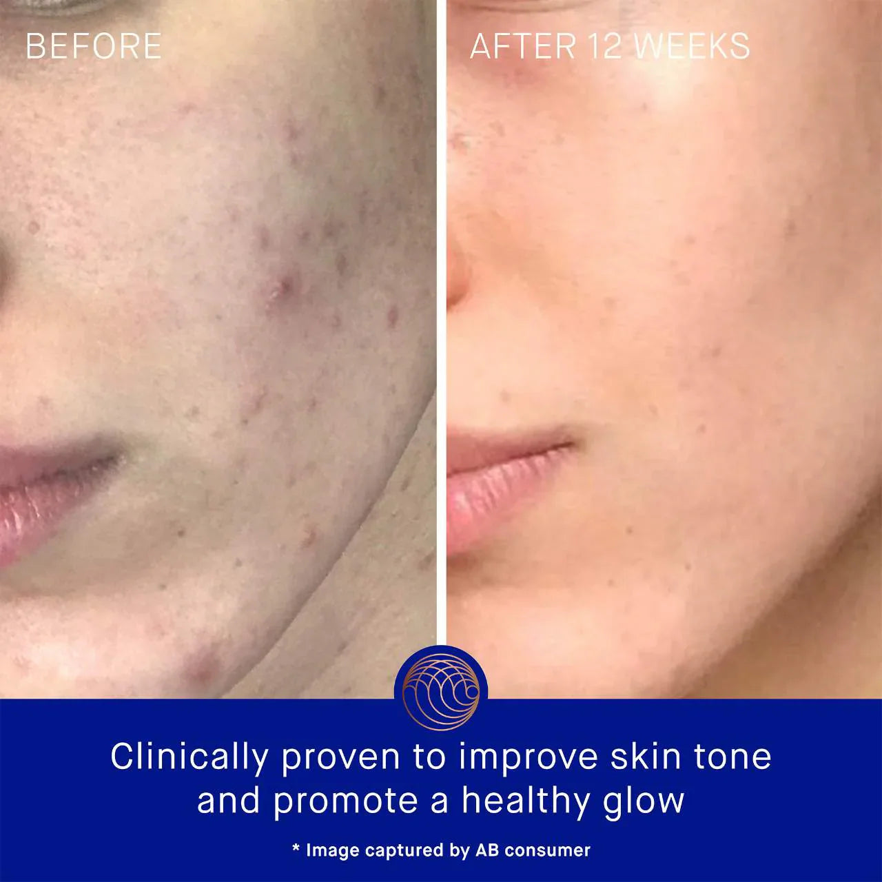 Crema Facial TFC8®