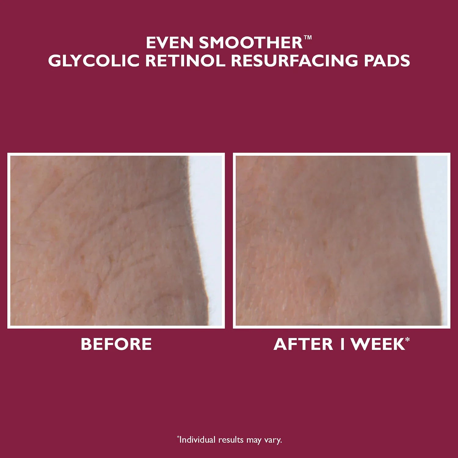 Even Smoother™ Toallitas Exfoliantes con Retinol y Ácido Glicólico