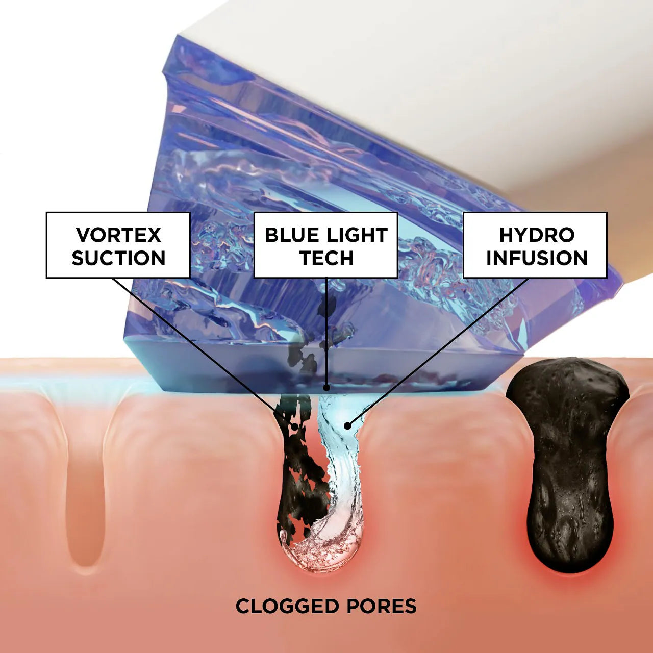 GLOfacial Hydro-Infusion Herramienta Limpiadora de Poros + Luz LED Azul