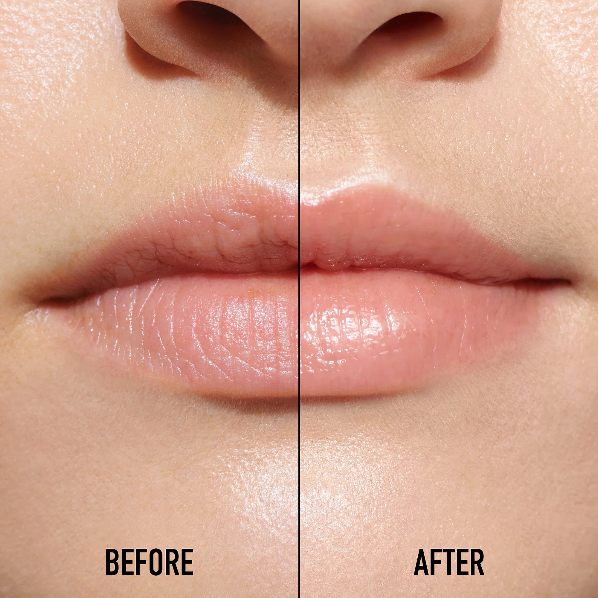 Sérum Voluminizador de Labios – Lip Maximizer Serum