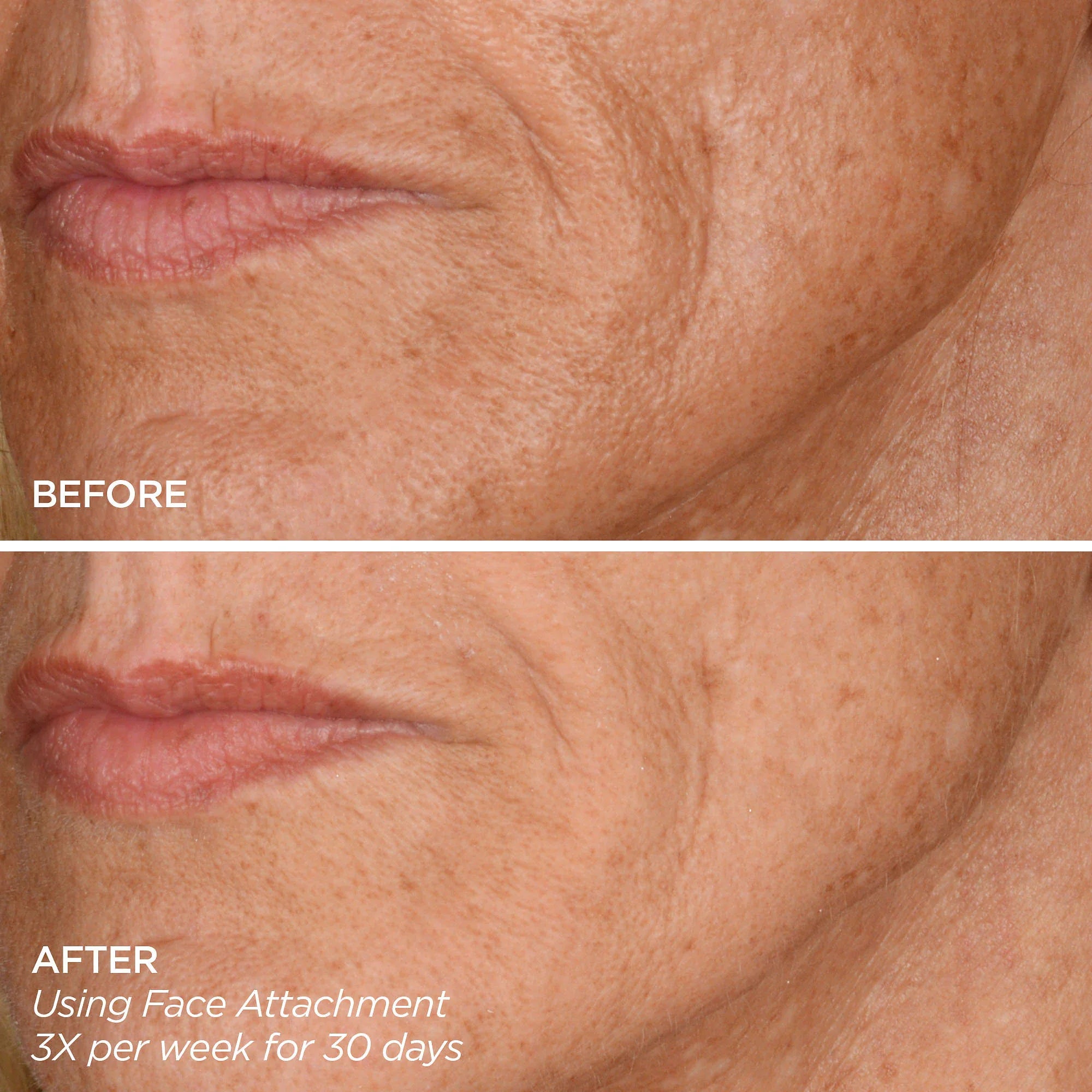Get That Glow – Kit GloPRO® de Microneedling y Productos de Descubrimiento