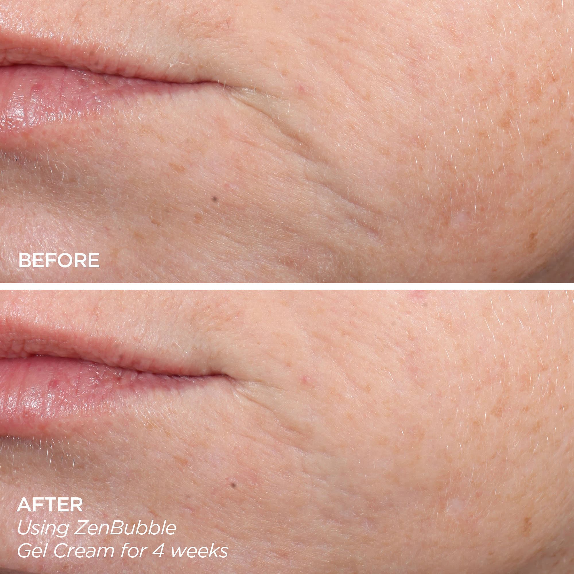 Get That Glow – Kit GloPRO® de Microneedling y Productos de Descubrimiento
