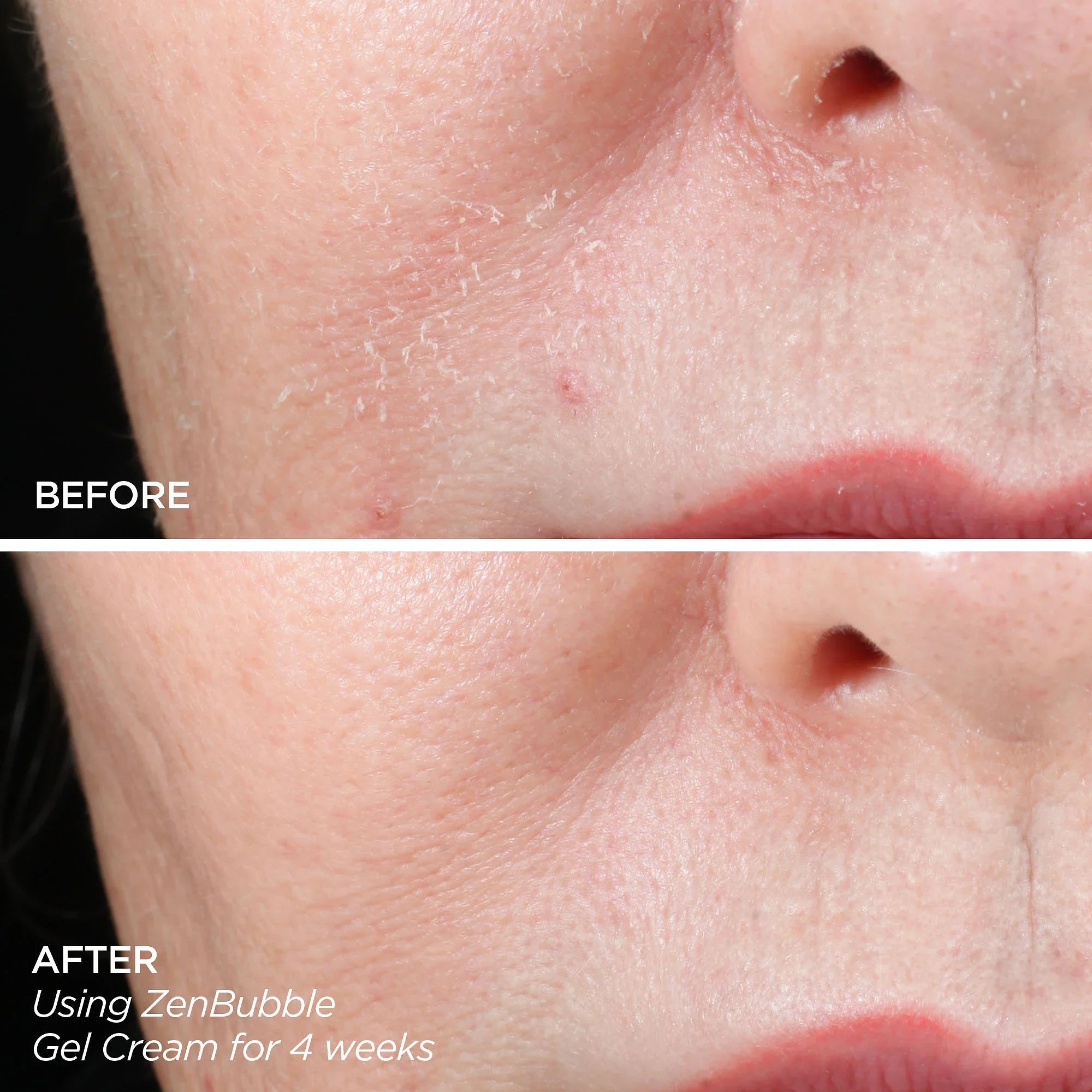 Get That Glow – Kit GloPRO® de Microneedling y Productos de Descubrimiento