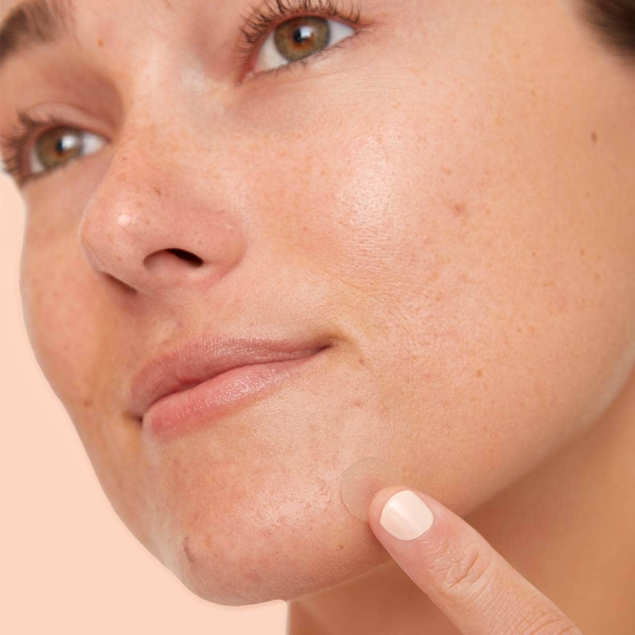 Parches antiacné con ácido salicílico – Tratamiento puntual para granos y brotes