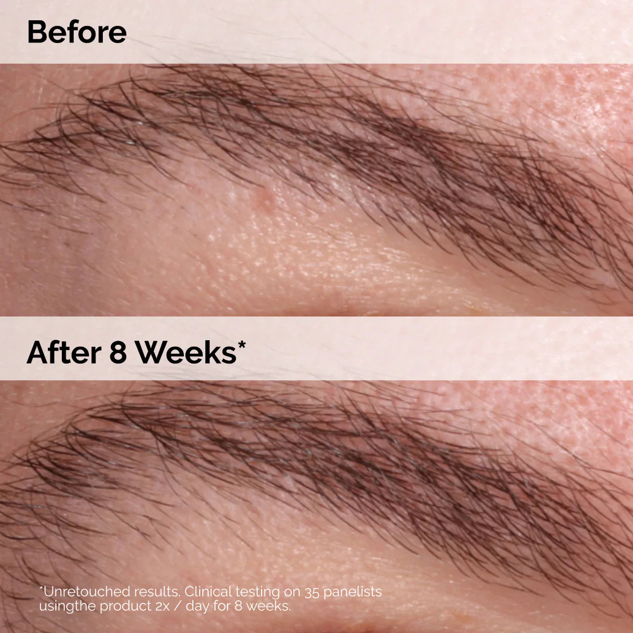 Sérum Multi-Péptidos para Pestañas y Cejas