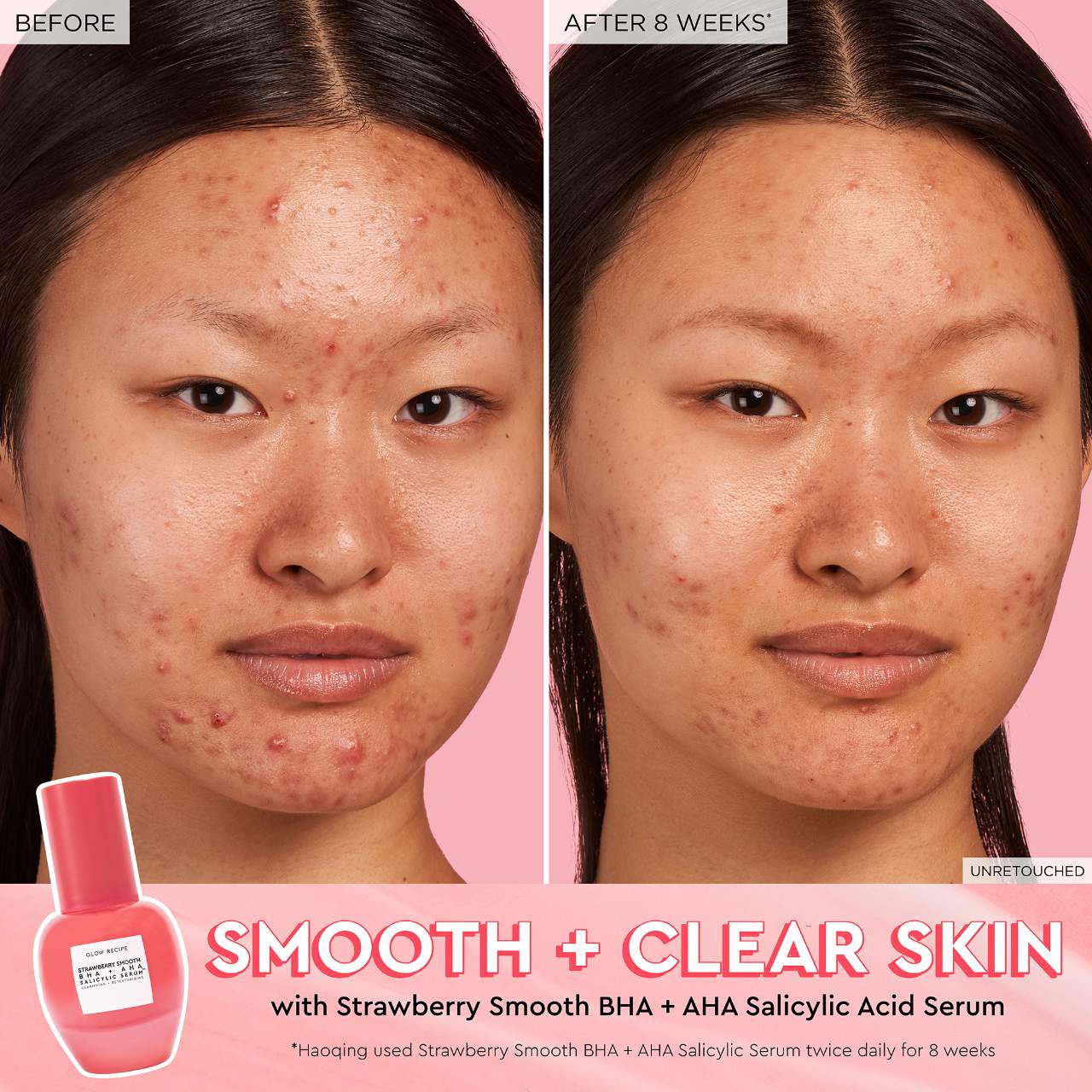 Sérum Strawberry Smooth – Exfoliante con ácido salicílico (BHA) + AHA