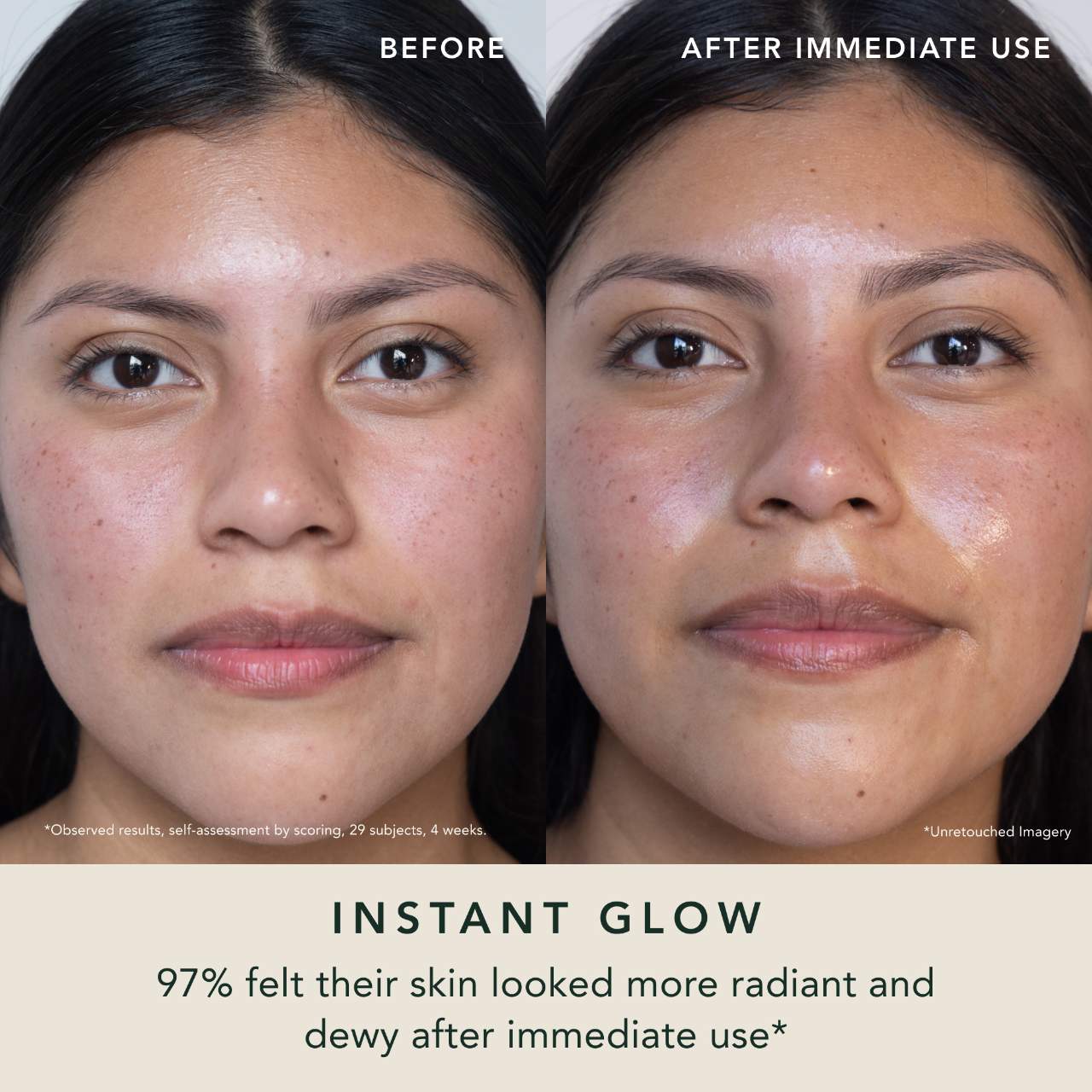 Radiant Rani – Tratamiento Iluminador de Manchas Oscuras con Azafrán