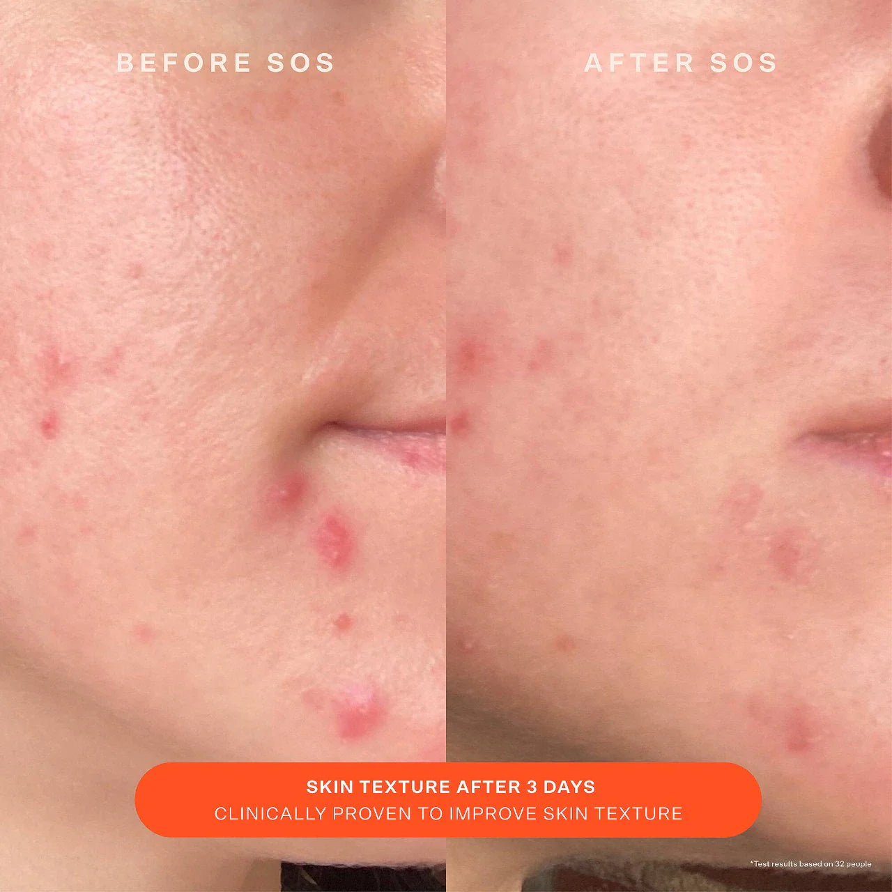 Crema hidratante SOS Daily Skin Barrier – Reparadora y calmante para piel enrojecida o sensibilizada