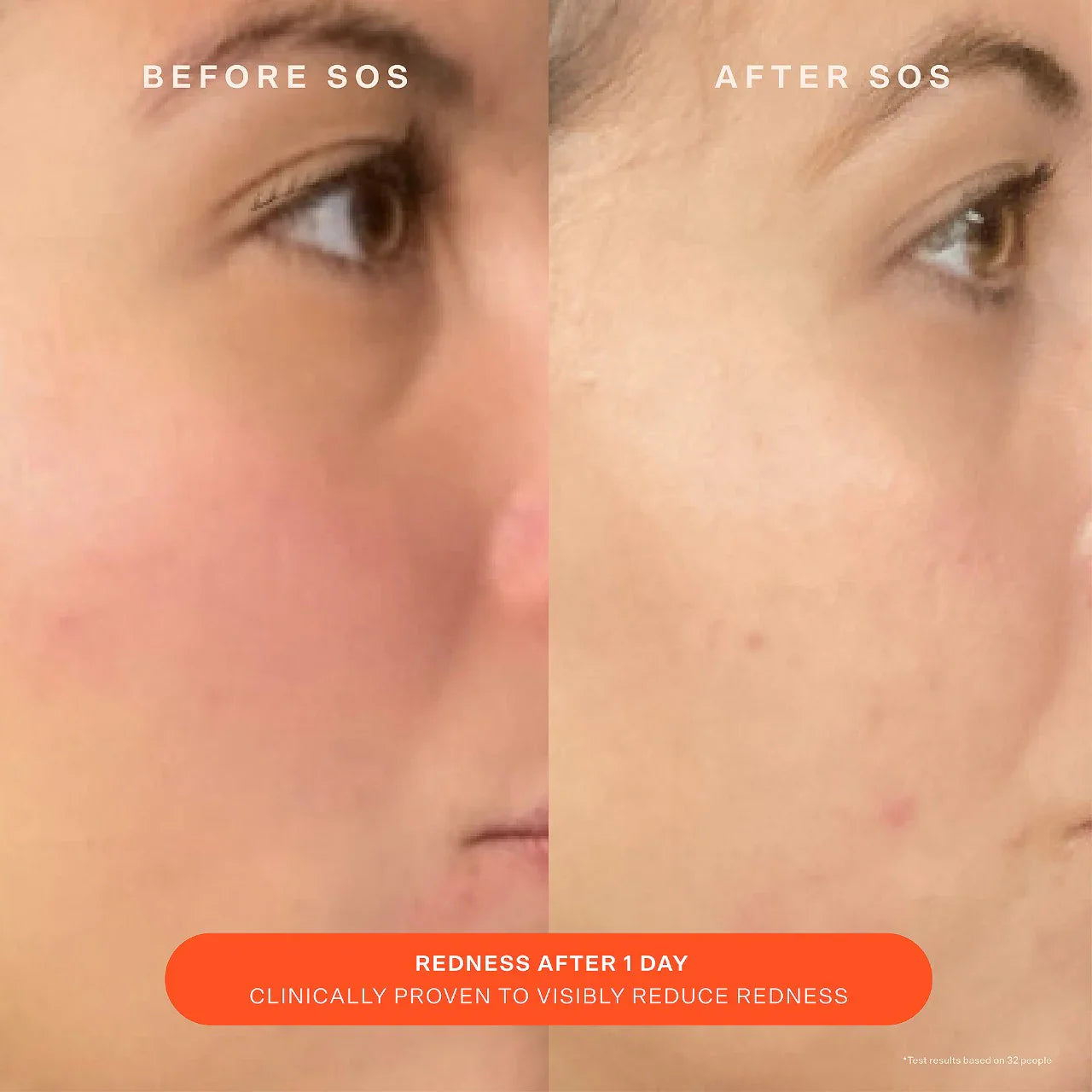 Crema hidratante SOS Daily Skin Barrier – Reparadora y calmante para piel enrojecida o sensibilizada