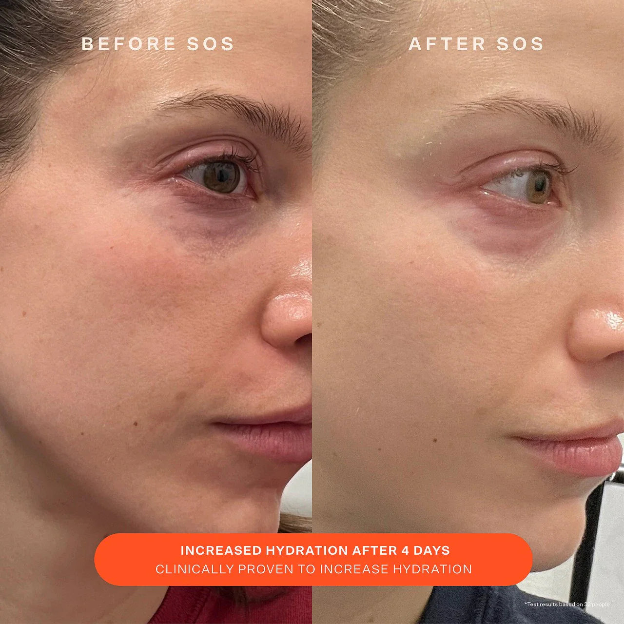 Crema hidratante SOS Daily Skin Barrier – Reparadora y calmante para piel enrojecida o sensibilizada