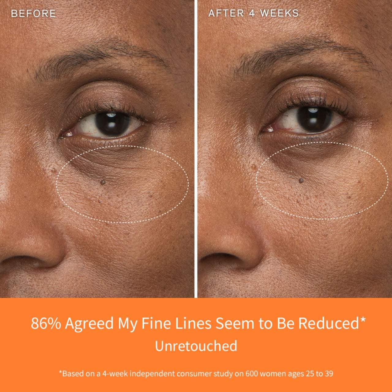 First Care Activating Serum Antiedad