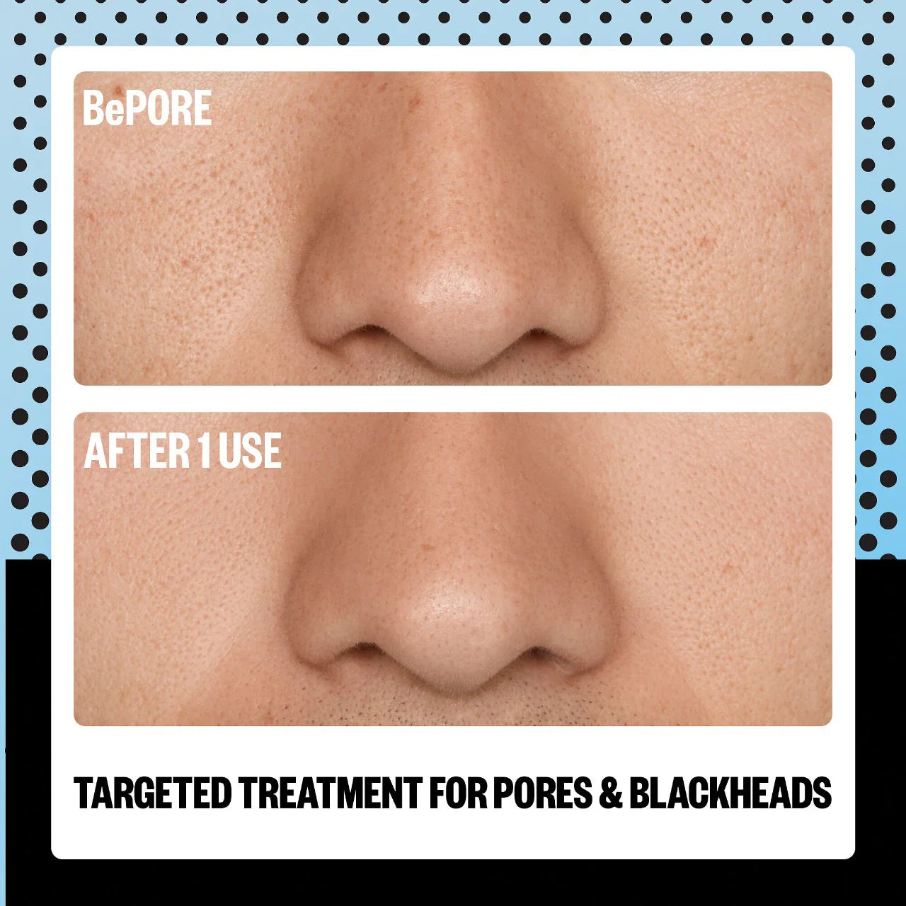 Stick exfoliante AHA Pore & Blackhead – Tratamiento multifunción para poros e impurezas