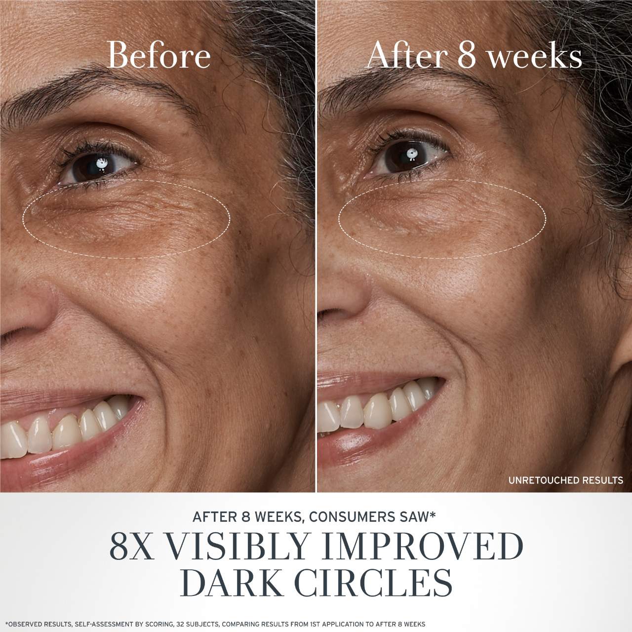 Crema Antiedad para Ojos con Té Negro y Alternativa al Retinol BT Matrix