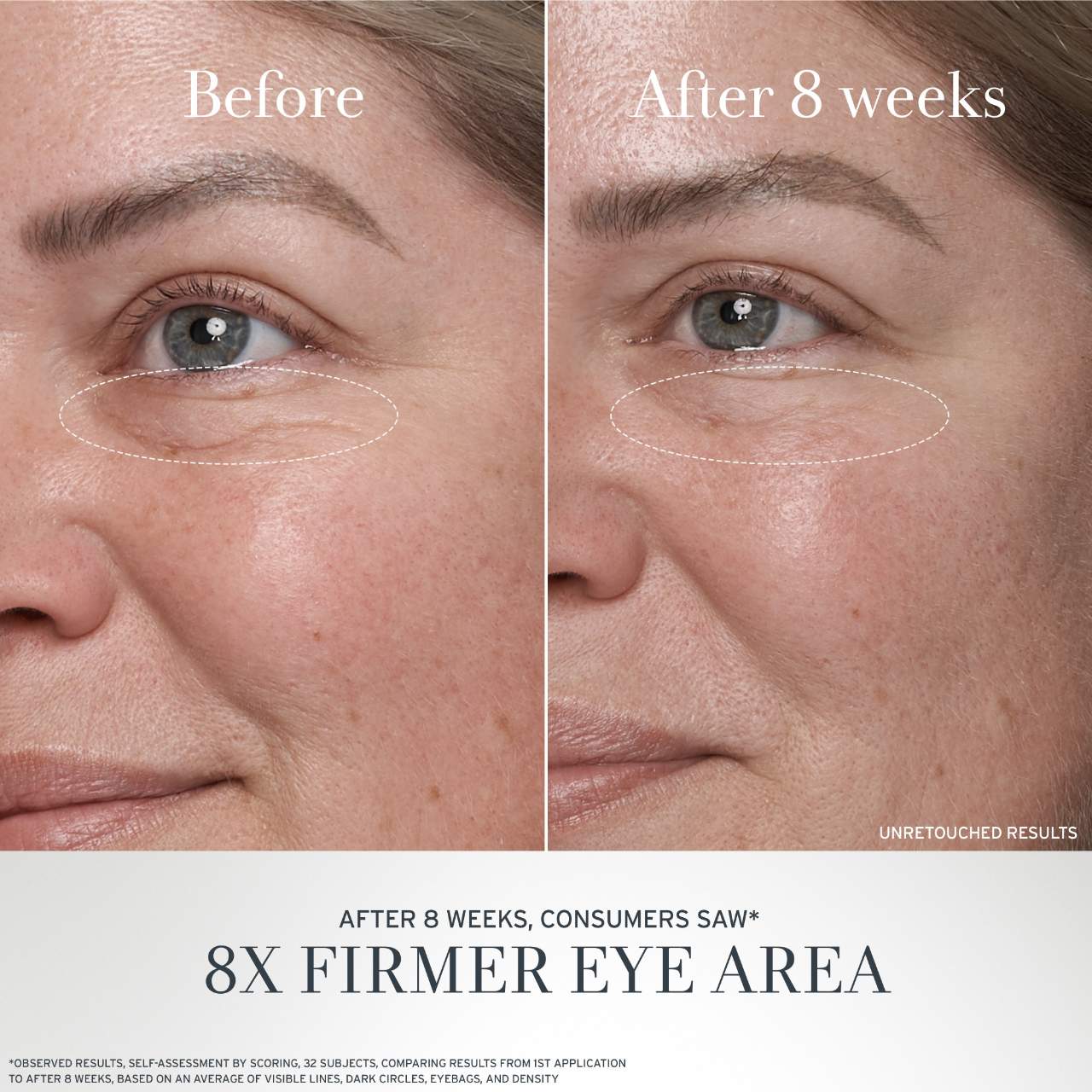 Crema Antiedad para Ojos con Té Negro y Alternativa al Retinol BT Matrix