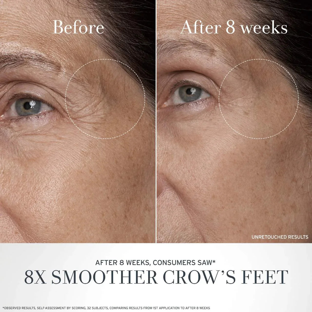 Crema Antiedad para Ojos con Té Negro y Alternativa al Retinol BT Matrix