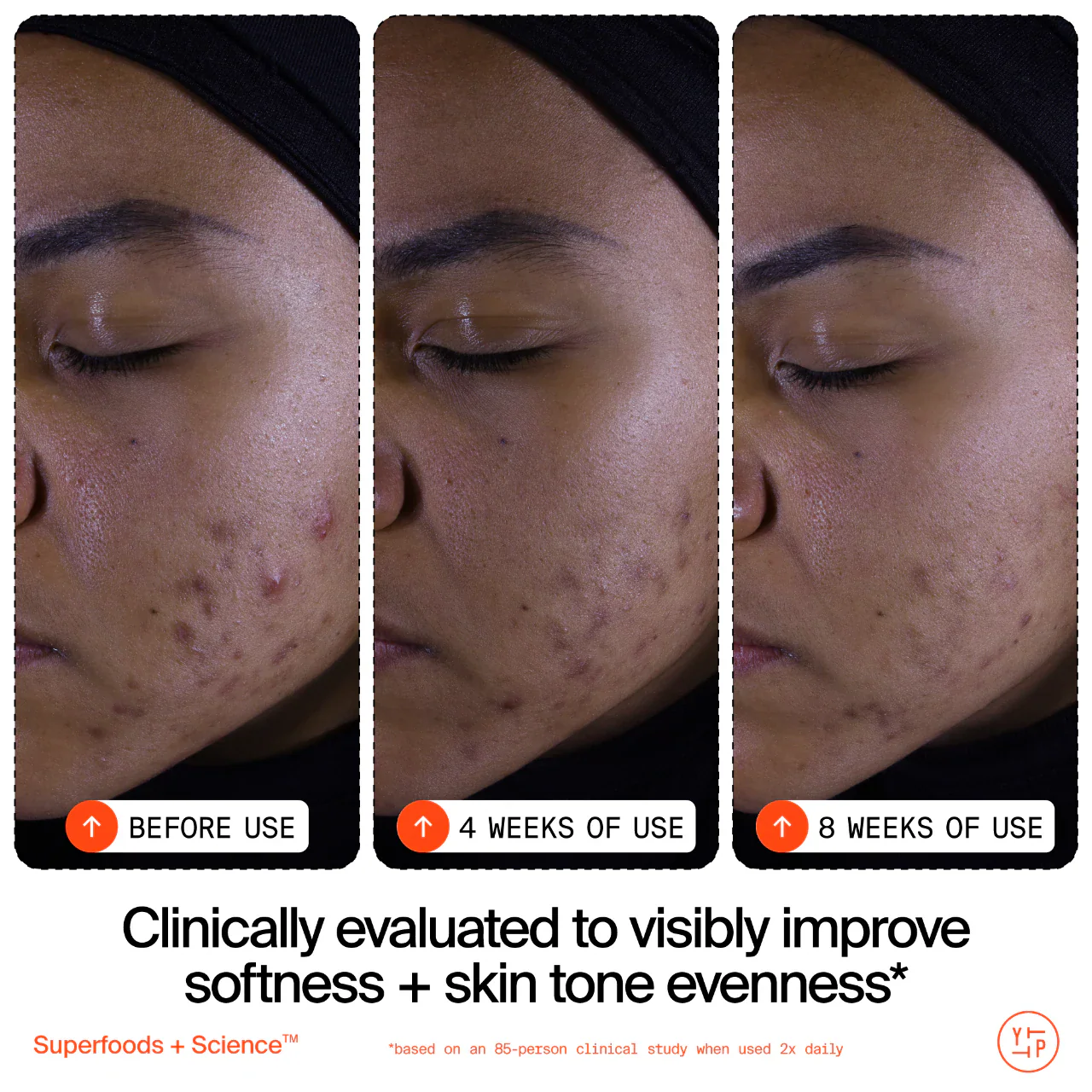 Limpiador exfoliante suave Superfruit – Con vitamina C y papaya