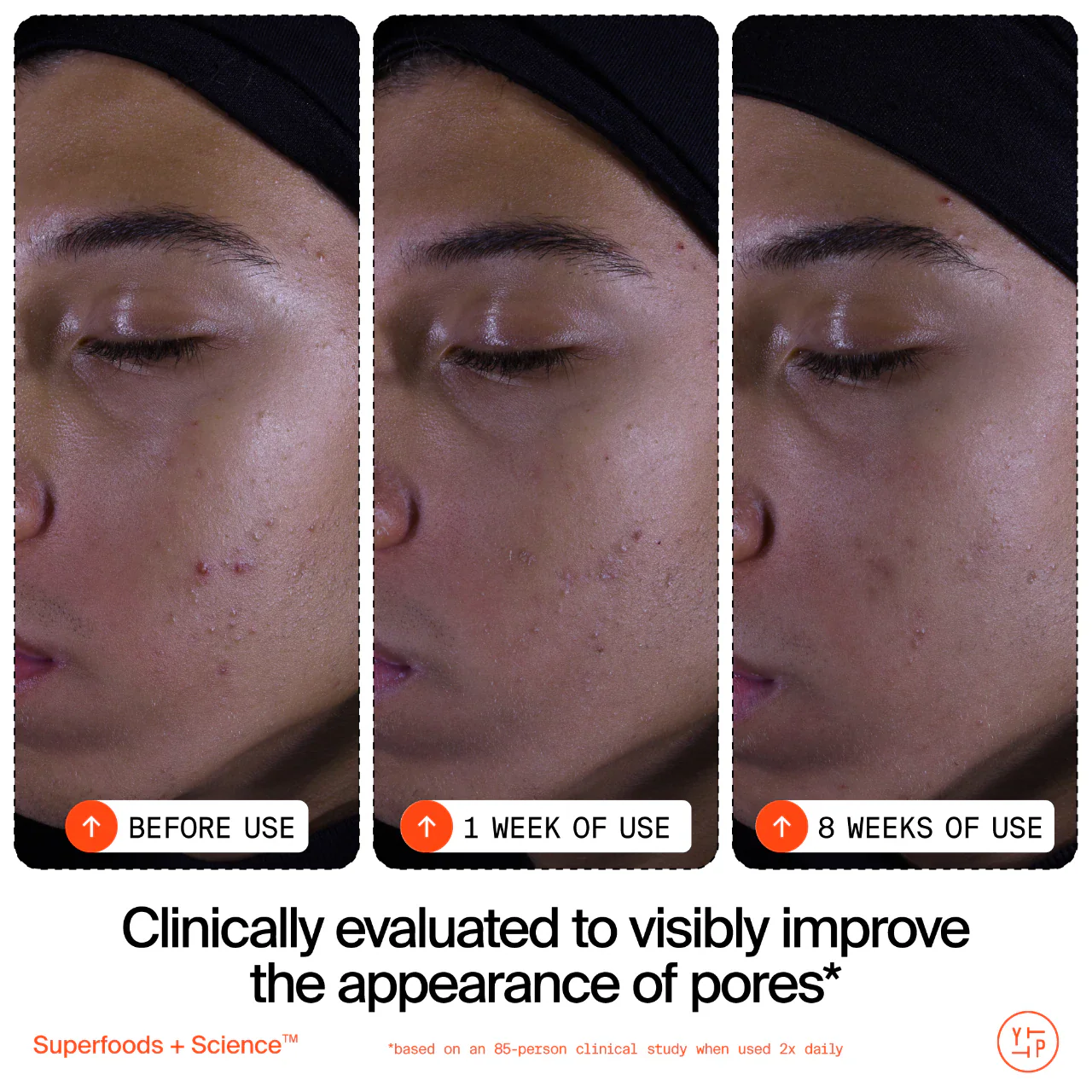 Limpiador exfoliante suave Superfruit – Con vitamina C y papaya