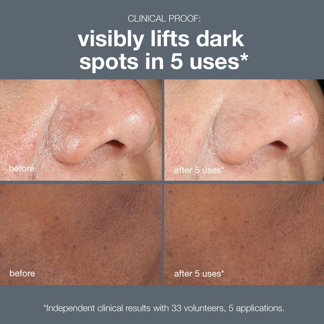 PowerBright Peel para Manchas Oscuras