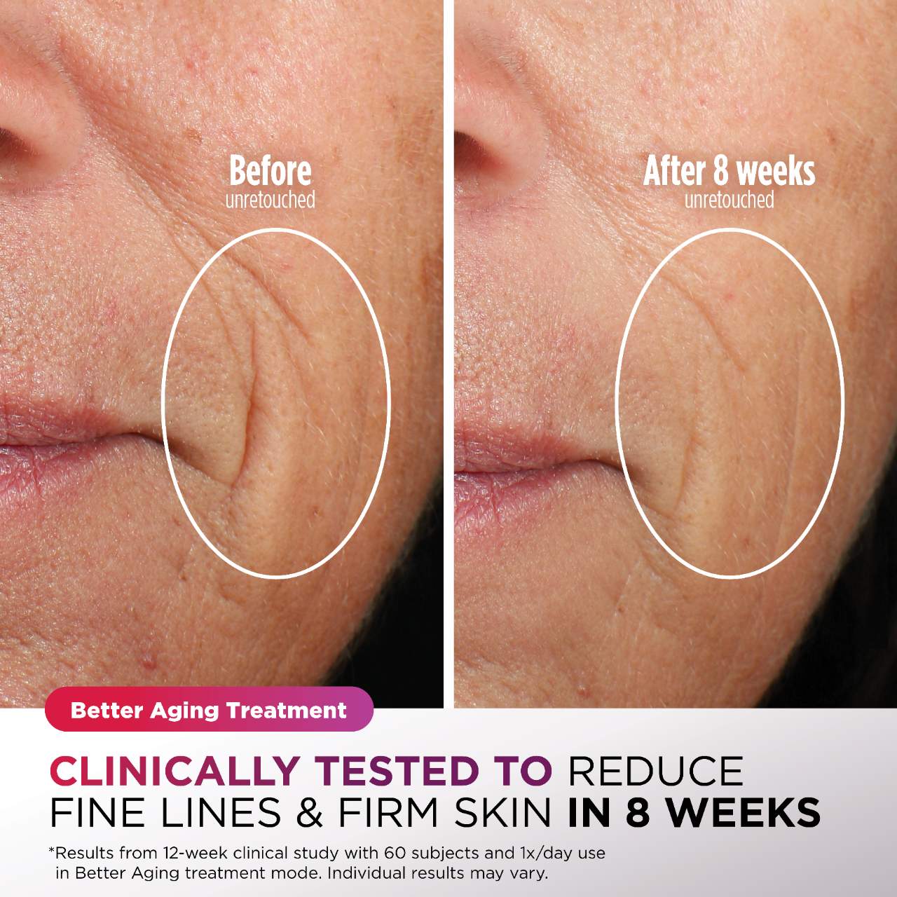 CryoGlow™ Mascarilla Facial con Efecto Frío y LED
