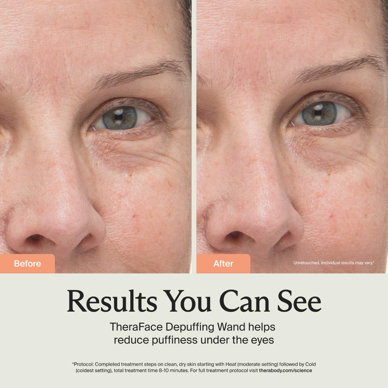 TheraFace Depuffing Wand para Ojeras y Bolsas Bajo los Ojos