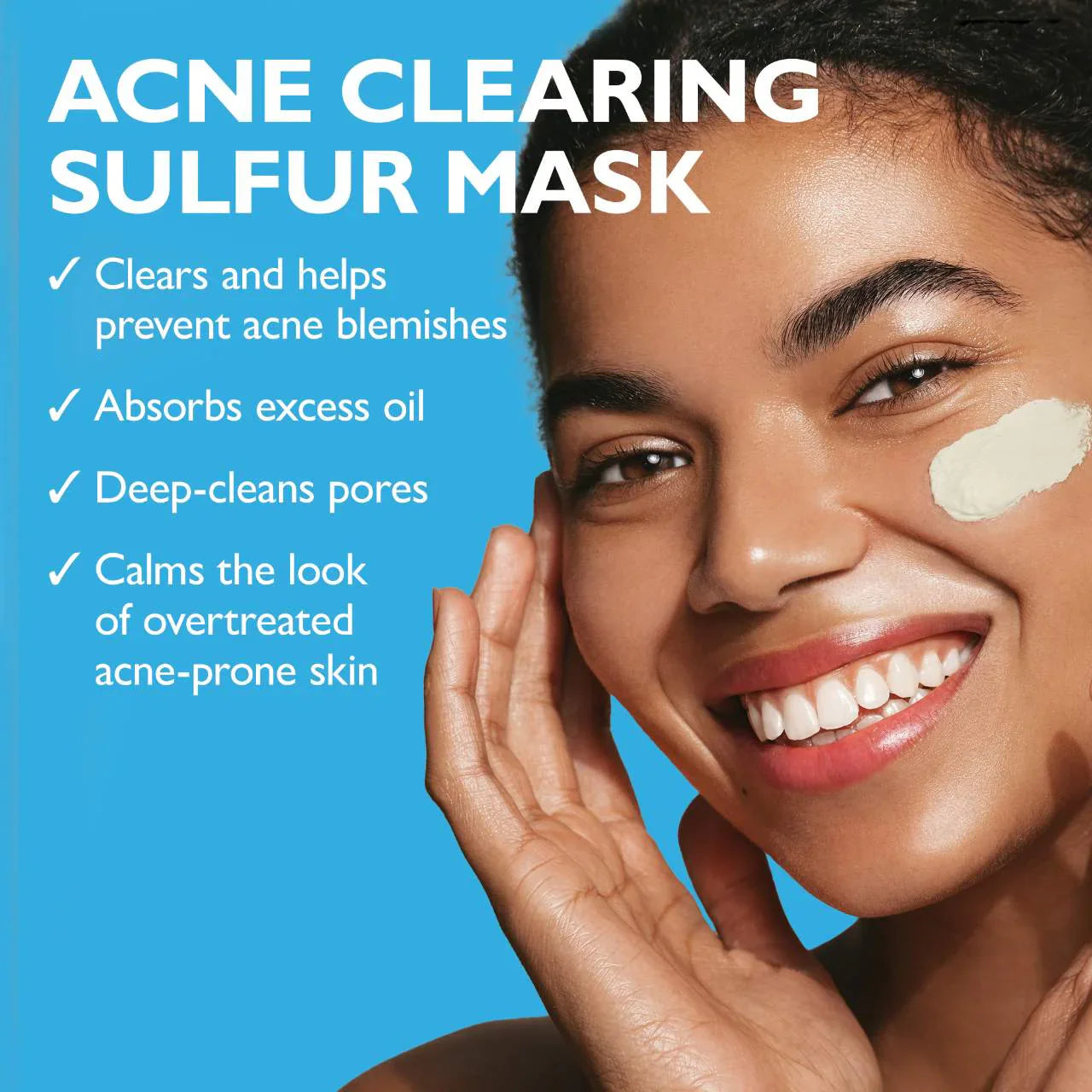 Mascarilla terapéutica Goodbye Acne™ con azufre – Tratamiento purificante antiacné