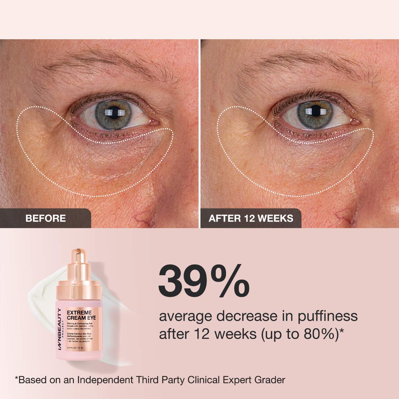 Extreme Cream Crema Reafirmante y Contorneadora para Ojos Recargable