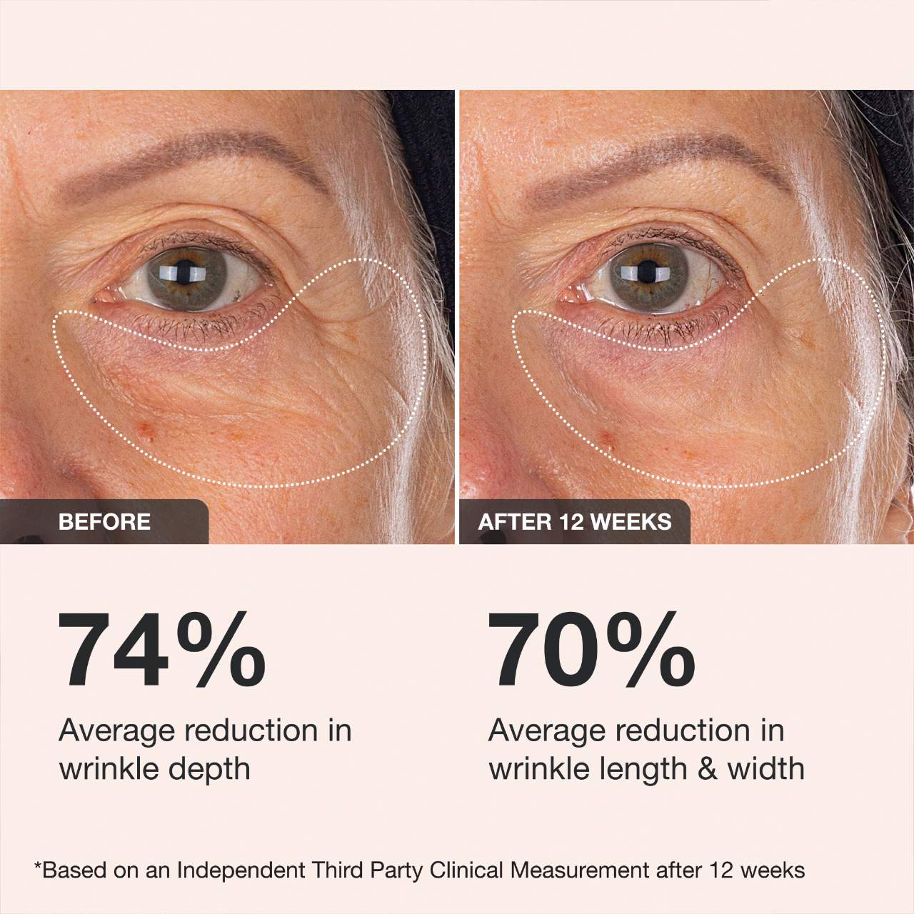Extreme Cream Crema Reafirmante y Contorneadora para Ojos Recargable