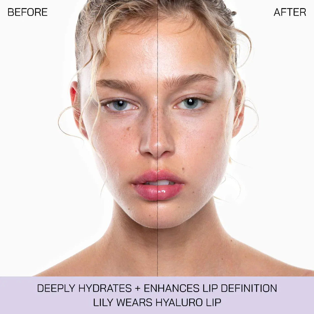 Hyalurolip – Voluminizador Labial con Ácido Hialurónico